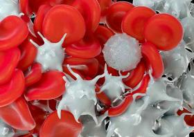 2026 Tutorial on Neoplastic Hematopathology: Focus on New Classifications